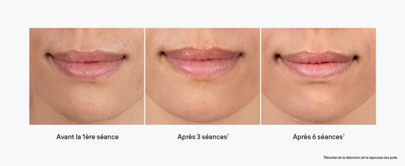 Image produit