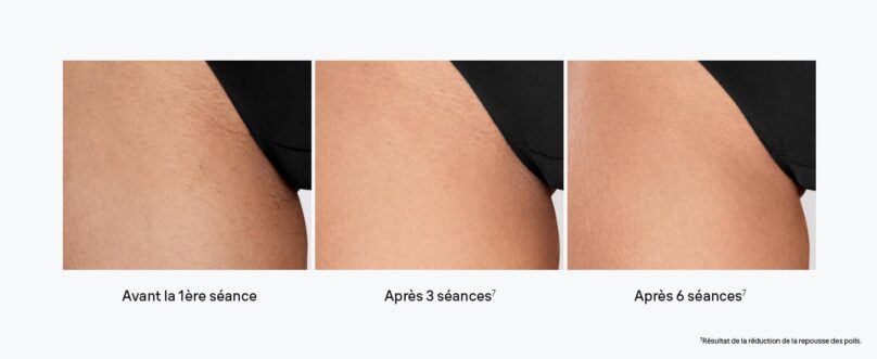 Image produit