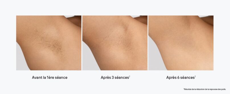 Image produit